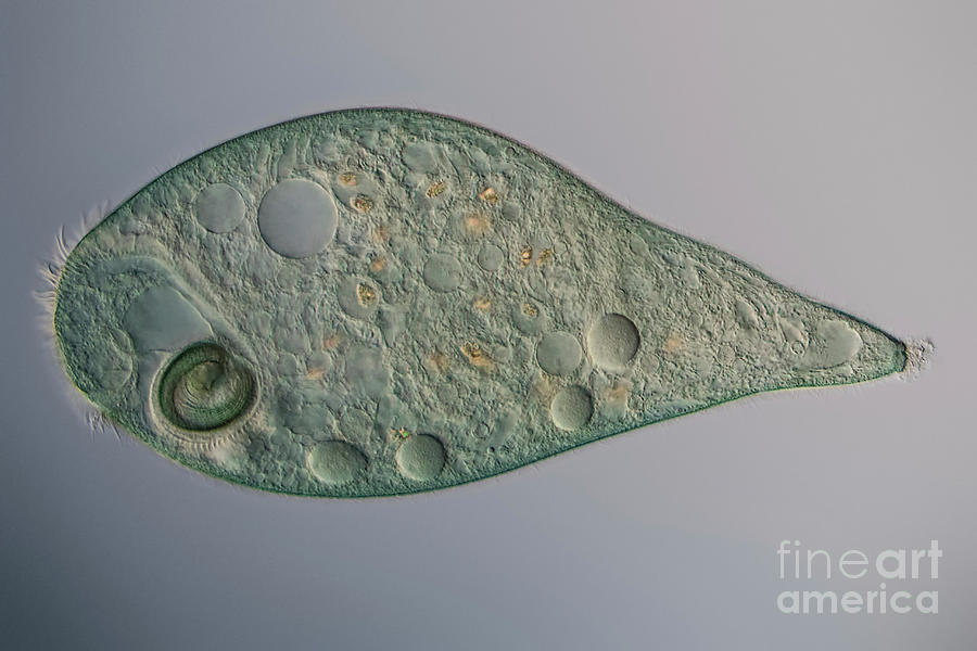 Nature Photograph - Stentor Sp. Protozoa by Hakan Kvarnstrom / Science Photo Library