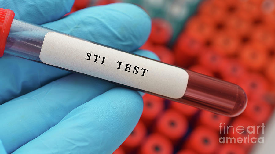 Sti Test Photograph by Wladimir Bulgar/science Photo Library - Pixels