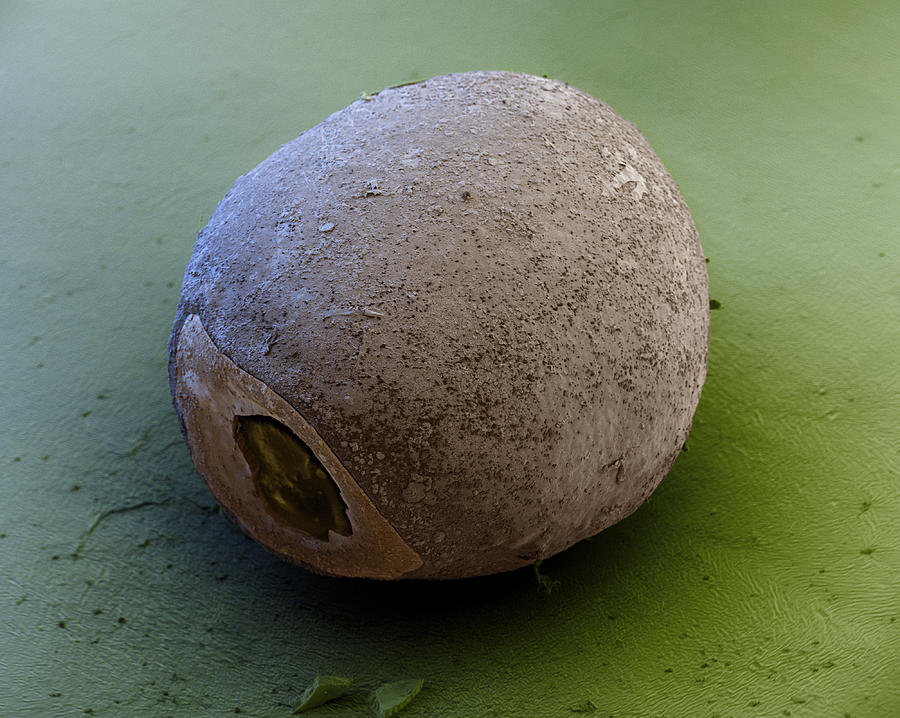 Stick Insect Egg Case, Sem Photograph by Meckes/ottawa