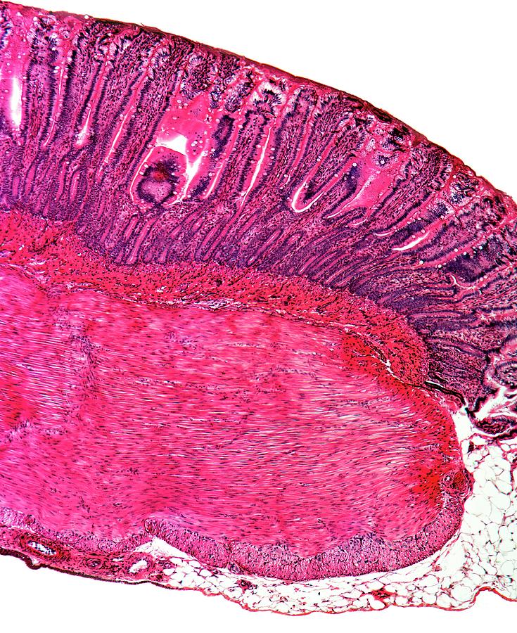 Stomach Section Photograph by Dr Keith Wheeler/science Photo Library
