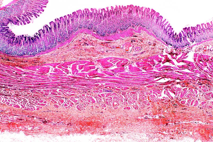 Stomach Wall Photograph by Dr Keith Wheeler/science Photo Library