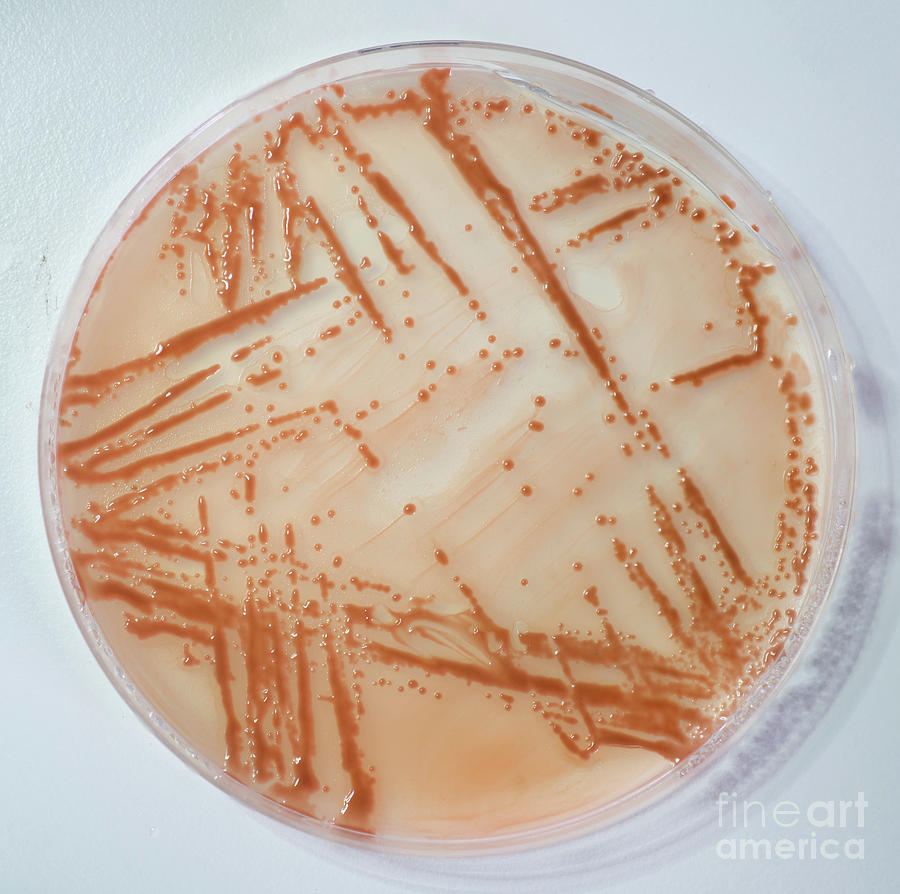 Stool Culture Photograph by Wladimir Bulgar/science Photo Library