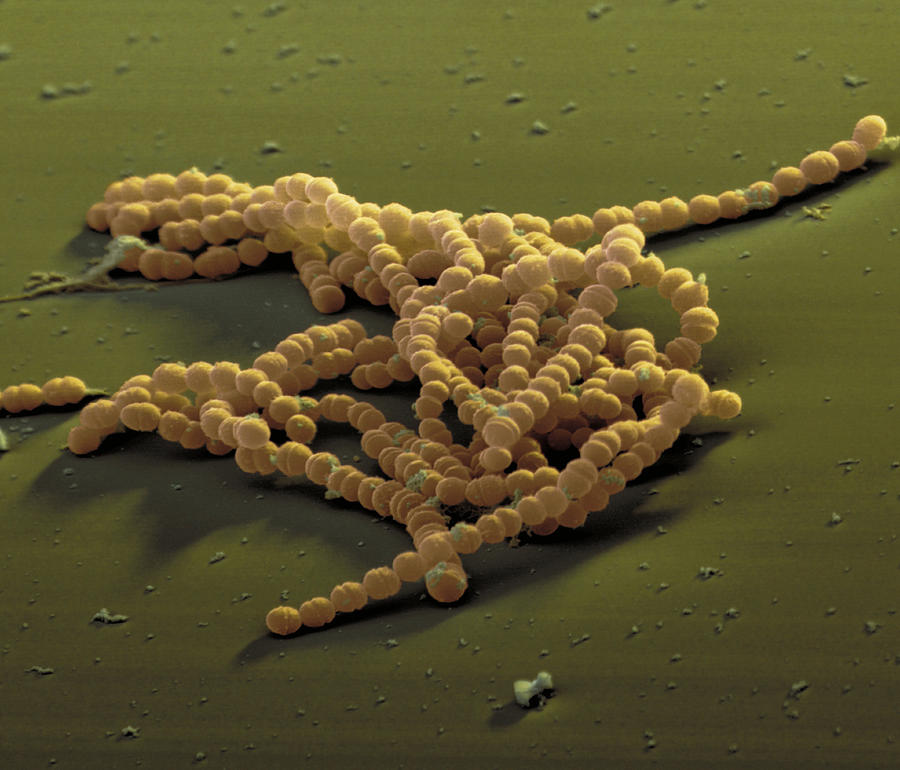 Streptococcus Agalactiae Photograph by Oliver Meckes EYE OF SCIENCE