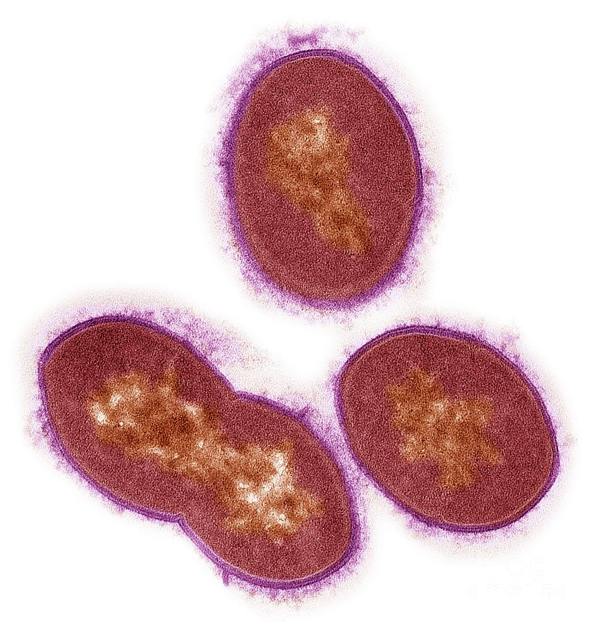 Streptococcus Bacteria Photograph by Steve Gschmeissner/science Photo Library