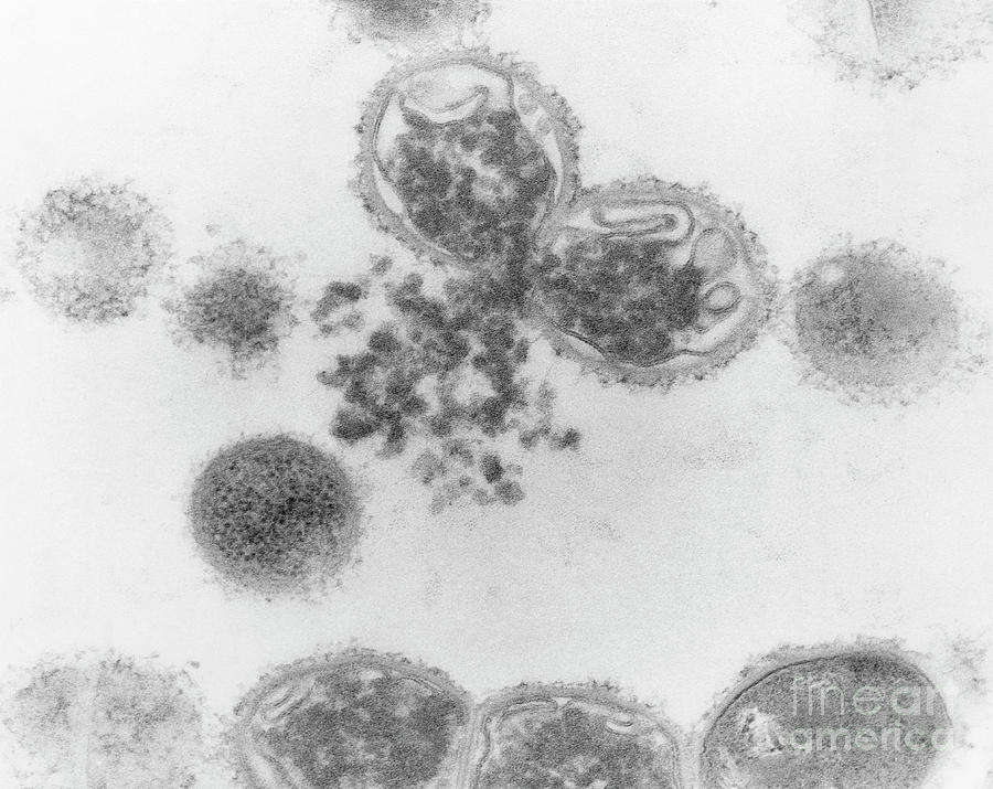 Streptococcus Mutans Bacteria Photograph by Dr Kari Lounatmaa/science Photo Library