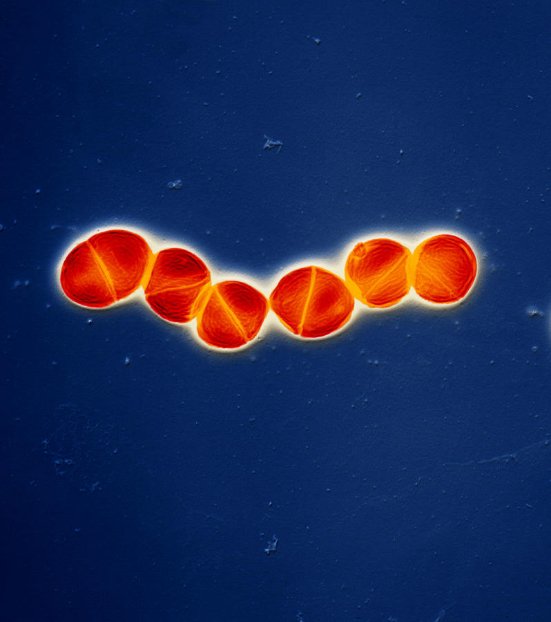 Streptococcus Pneumoniae Photograph by Meckes/ottawa