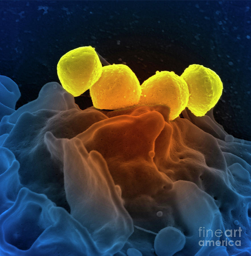 Streptococcus Pyogenes Bound To A Neutrophil Photograph By National ...