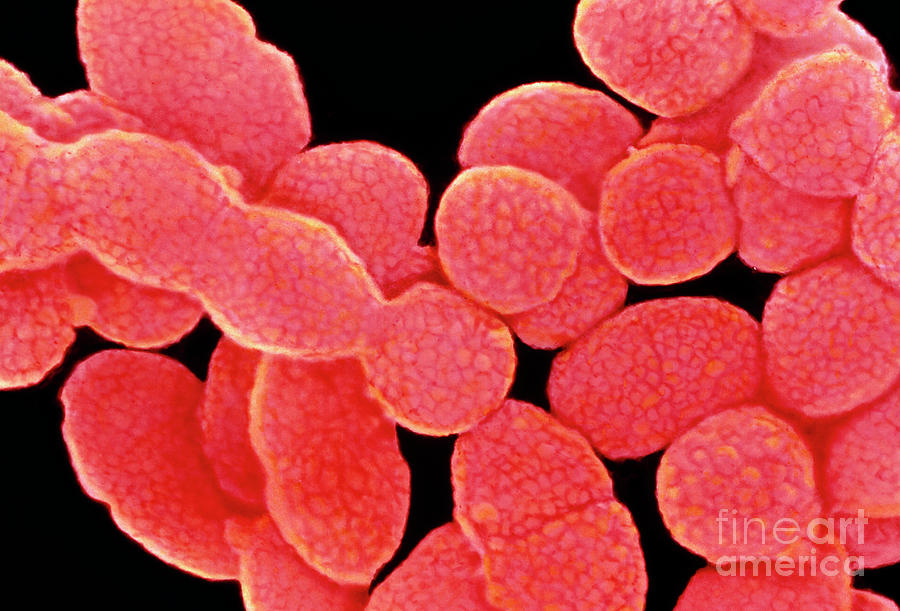 Streptococcus Pyogenes Group A Bacteria Photograph By Dr Kari Lounatmaa