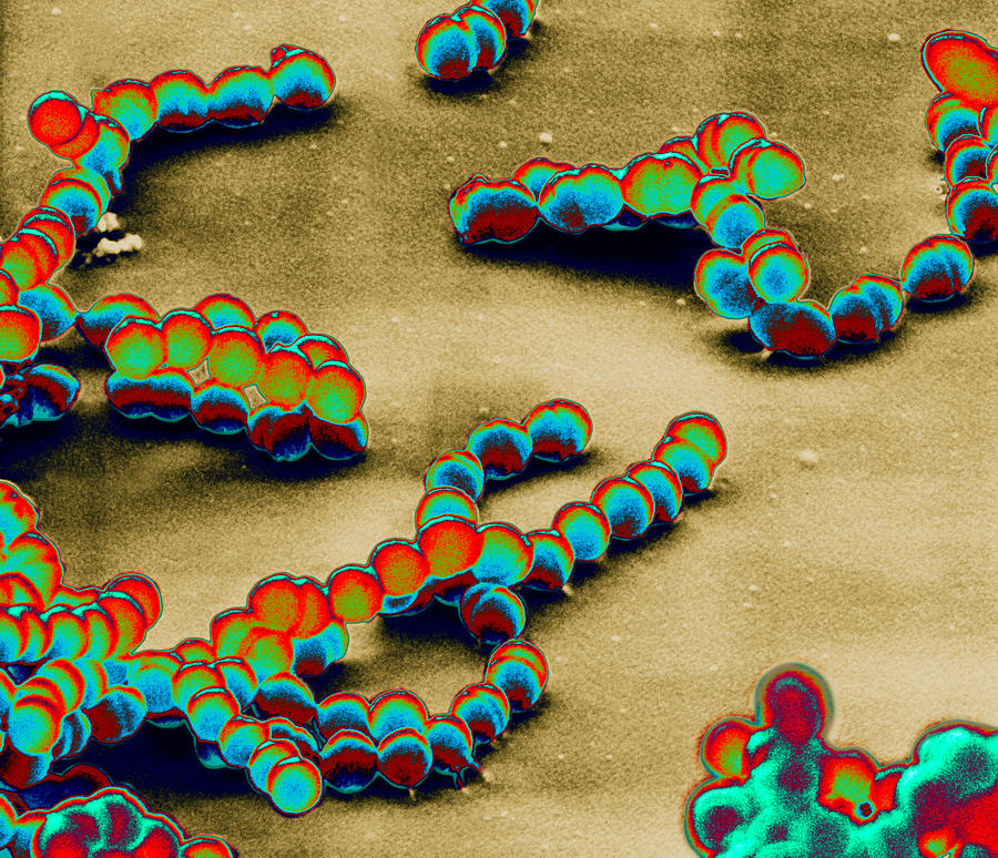 Streptococcus Pyogenes Photograph by Meckes/ottawa