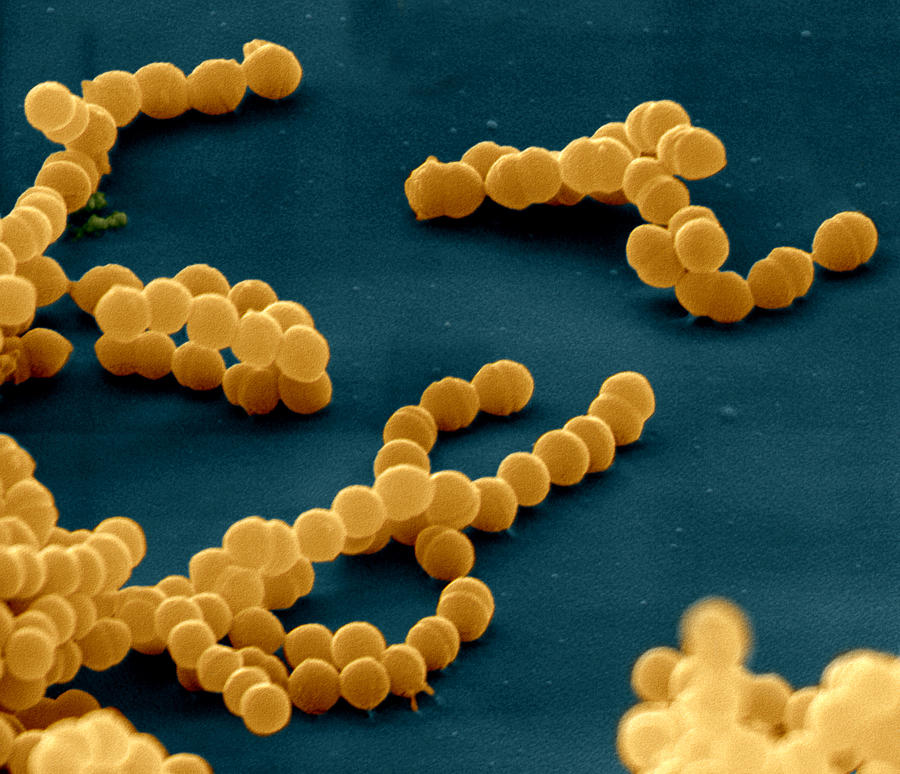 Streptococcus Pyogenes Photograph by Oliver Meckes EYE OF SCIENCE