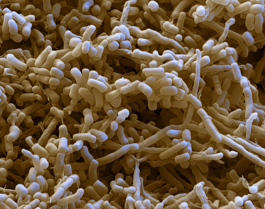Streptomyces Sp., Sem Photograph by Oliver Meckes EYE OF SCIENCE
