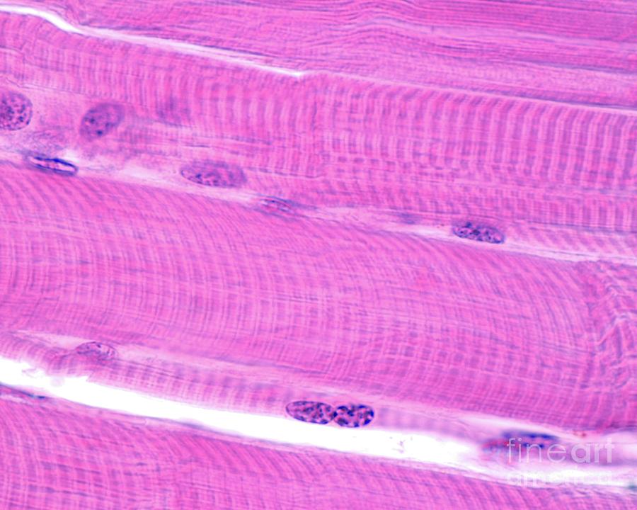 Striated Skeletal Muscle Fibres Photograph by Jose Calvo/science Photo Library