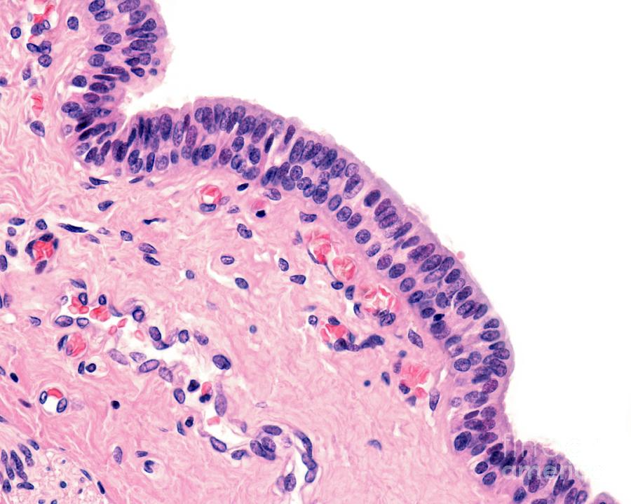 Submandibular Salivary Gland Photograph By Jose Calvoscience Photo