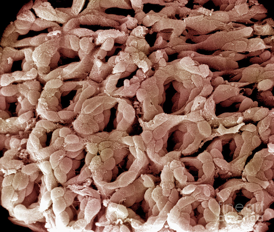 Stomach Photograph - Surface Of Pyloric Stomach by Dr. Richard Kessel & Dr. Randy Kardon / Science Photo Library