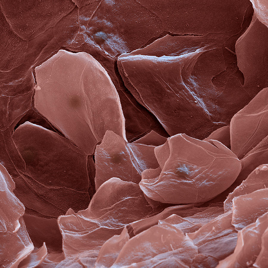 Surface Of The Tongue Sem Photograph by Meckes/ottawa