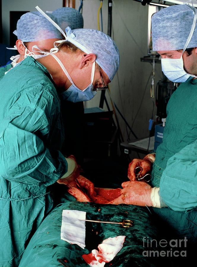 Surgery To Perform A Radical Hysterectomy Photograph By Simon Fraser
