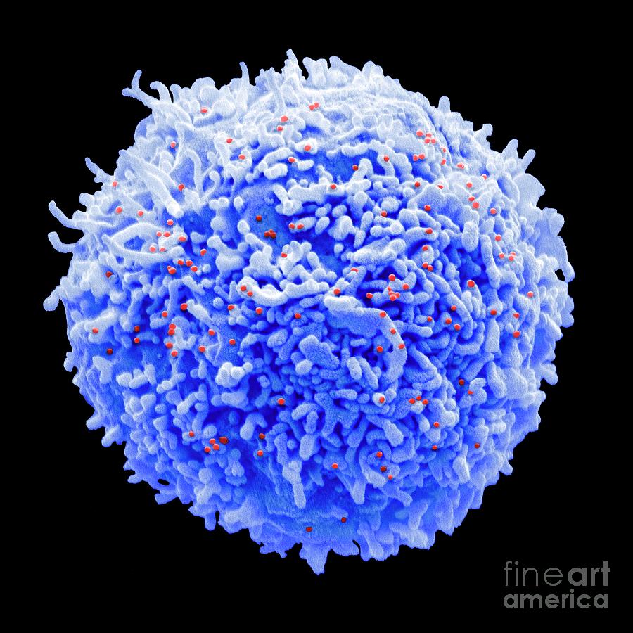 T-cell Infected With Hiv Photograph by Steve Gschmeissner/science Photo Library
