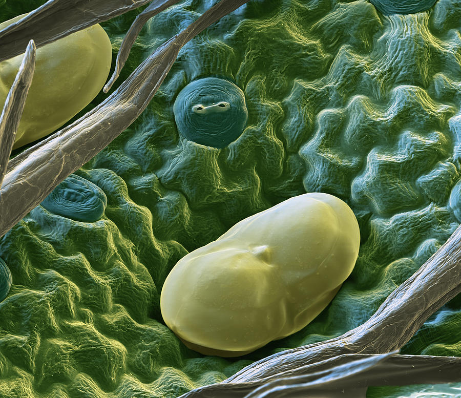Tanacetum Trichome, Sem Photograph by Oliver Meckes EYE OF SCIENCE