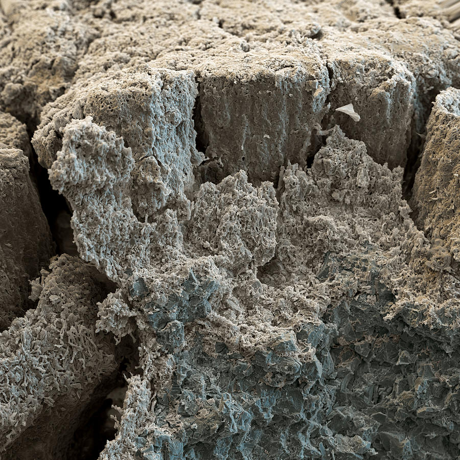 Tar Lichen Photograph by Meckes/ottawa