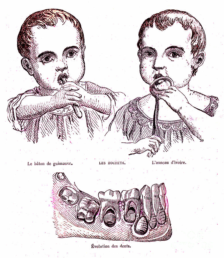 Teething And Child Teeth Development Photograph by Collection Abecasis/science Photo Library