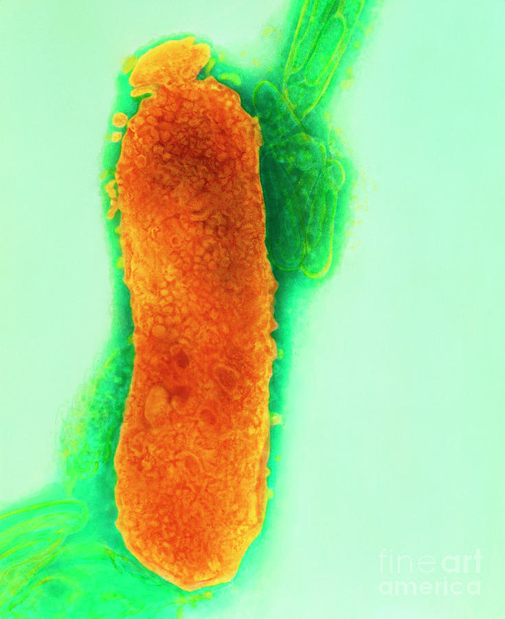 Tem Of Fusobacterium Necrophorum Photograph by Dr Kari Lounatmaa/science Photo Library