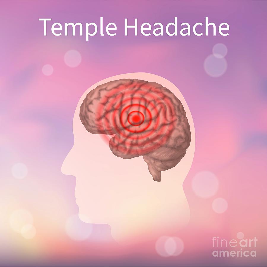 Temple Headache Photograph by Veronika Zakharova/science Photo Library
