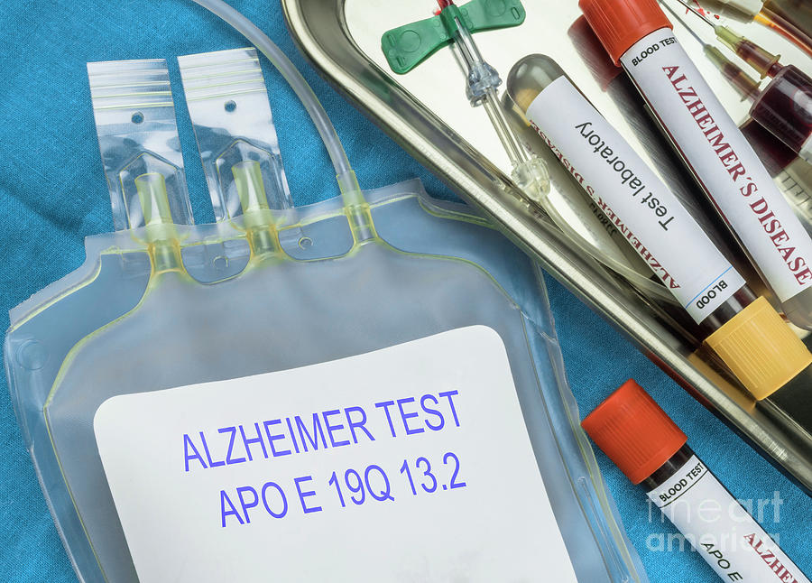 Testing For Alzheimers Disease Photograph by Digicomphoto/science Photo Library