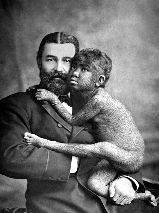 The Great Farini With Krao, 1883 Photograph by Science Source