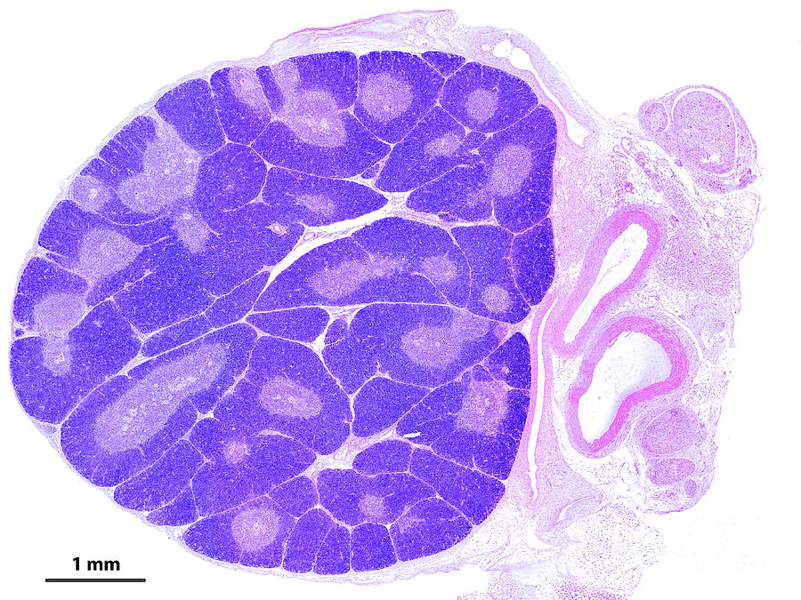 Thymus Photograph by Jose Calvo / Science Photo Library - Fine Art America