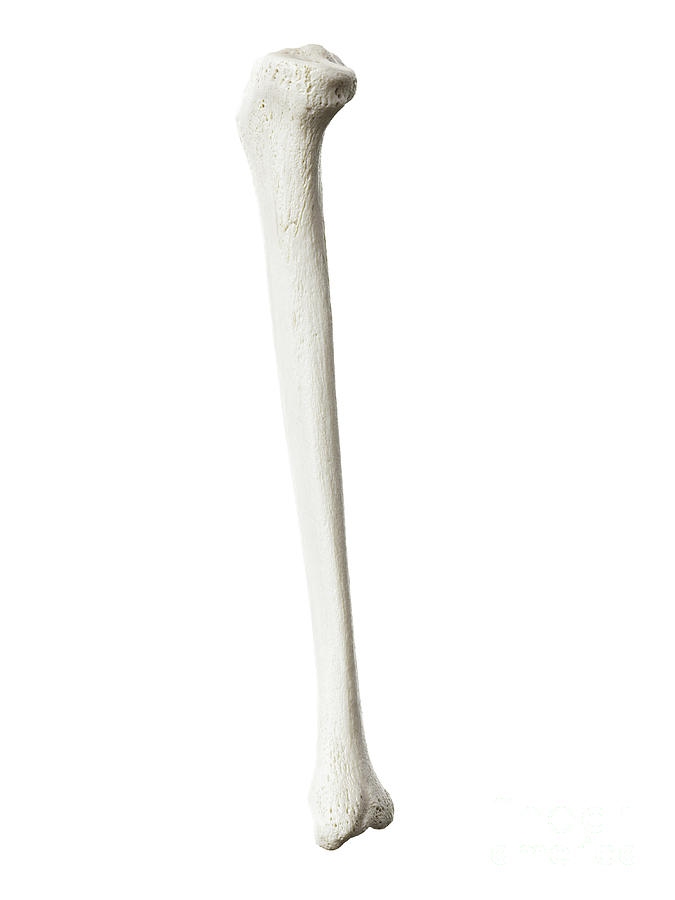 Tibia Photograph by Sebastian Kaulitzki/science Photo Library - Fine ...