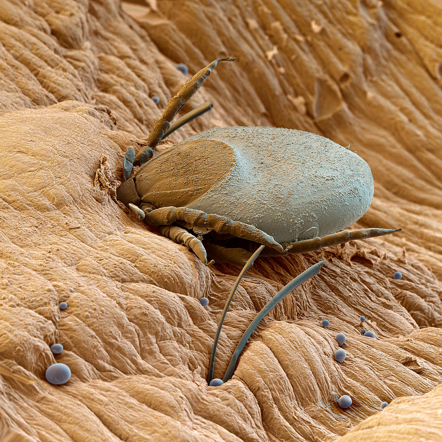 Tick Feeding On Human Blood Photograph by Oliver Meckes EYE OF SCIENCE