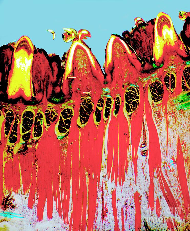 Tongue Tissue Photograph by Dr Keith Wheeler/science Photo Library