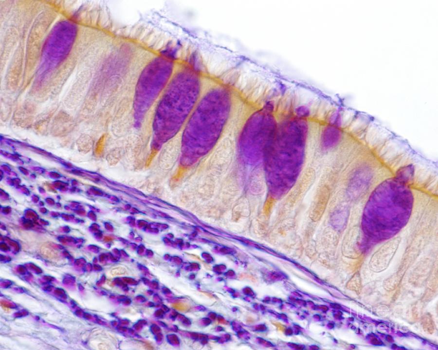 Trachea And Oesophagus Photograph by Jose Calvo/science Photo Library ...