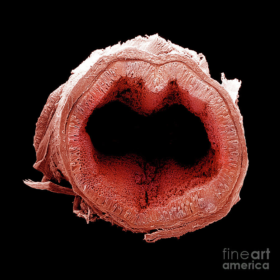 Transverse Section Of The Colon Photograph by Dr. Richard Kessel & Dr. Randy Kardon / Science Photo Library