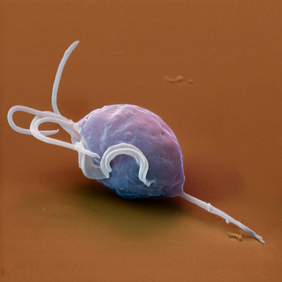 Trichomonas Vaginalis Photograph by Oliver Meckes EYE OF SCIENCE