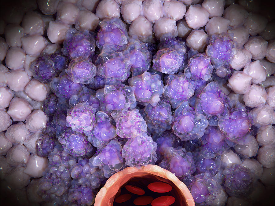 Tumor Growing Around A Blood Vessel Photograph by Juan Gaertner - Fine ...