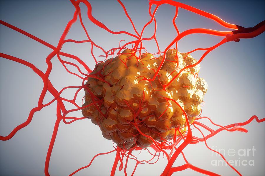 Tumour And Blood Vessels by Ella Maru Studio / Science Photo Library