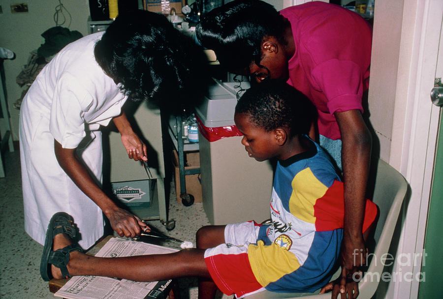 Ulcer Treatment Photograph - Ulcer Treatment Of Sickle Cell Child In Clinic by Sue Ford/science Photo Library