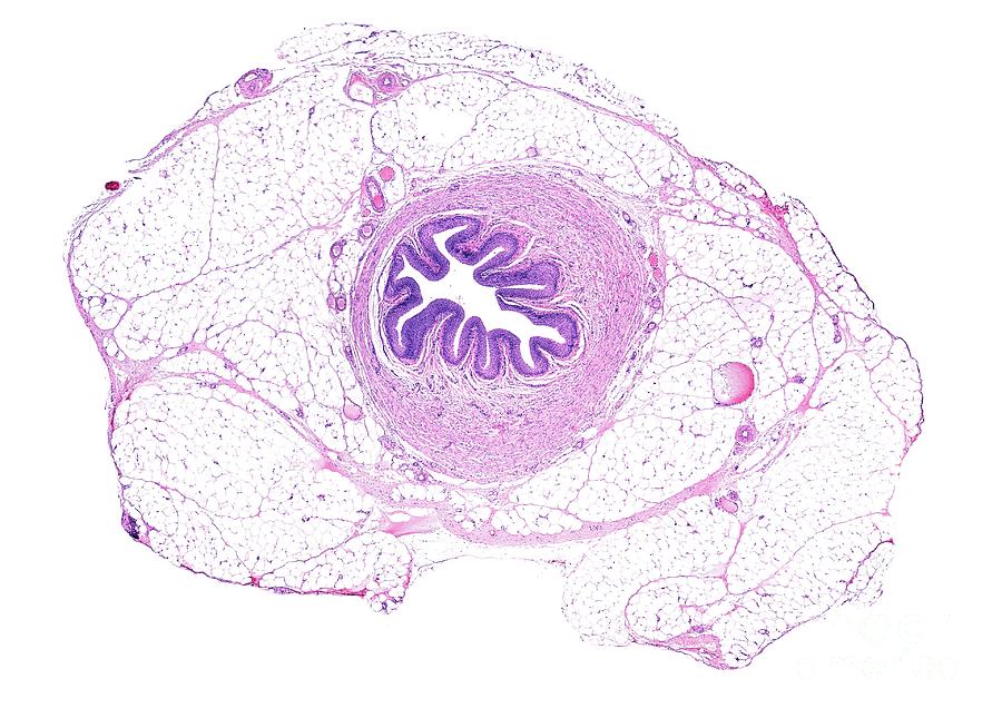 Ureter Photograph by Jose Calvo/science Photo Library