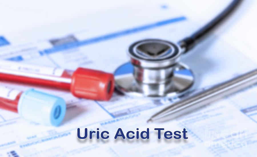 Uric Acid Test Photograph by Wladimir Bulgar/science Photo Library