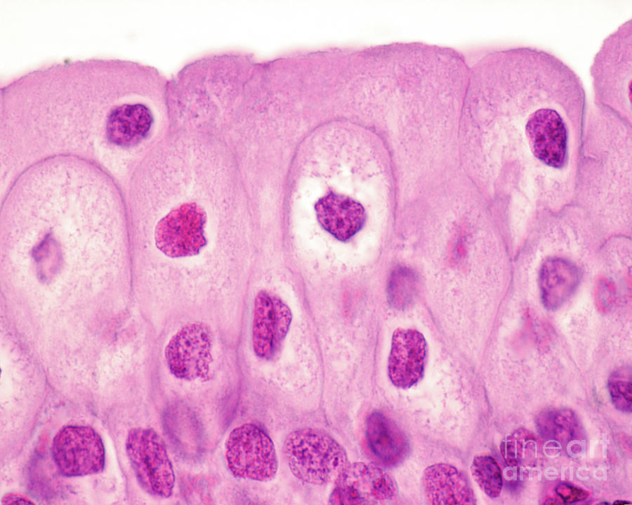 Urinary Bladder Epithelium By Jose Calvo Science Photo Library