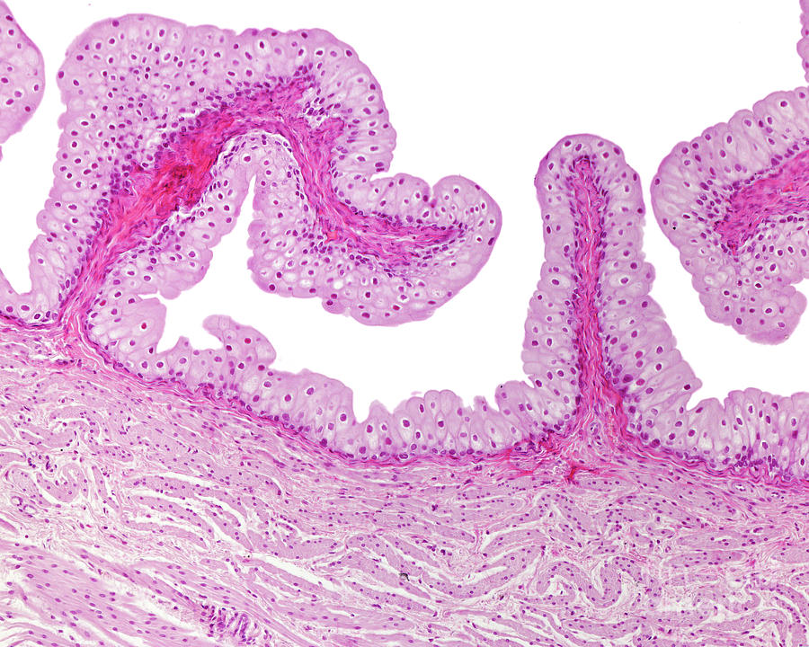 Urinary Bladder Photograph by Jose Calvo / Science Photo Library