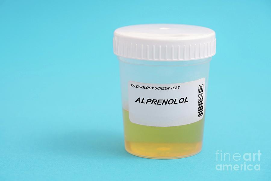 https://images.fineartamerica.com/images/artworkimages/mediumlarge/2/urine-test-for-alprenolol-wladimir-bulgarscience-photo-library.jpg