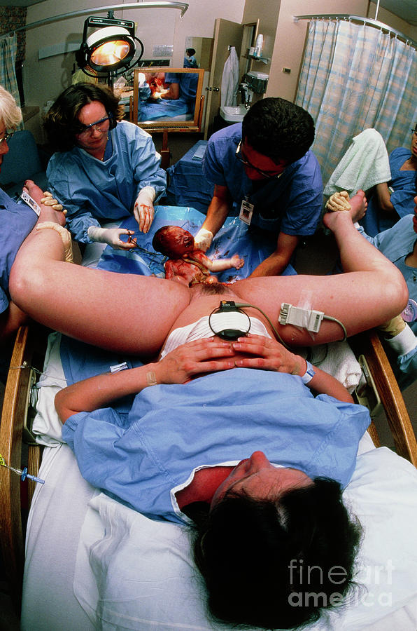 View Of A Baby Emerging During Hospital Childbirth Photograph by David Nunuk/science Photo Library