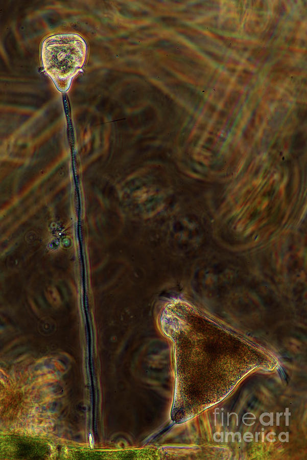 Vorticella