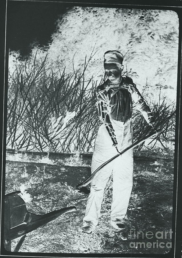 War Veteran Spading With Artificial Photograph by Bettmann