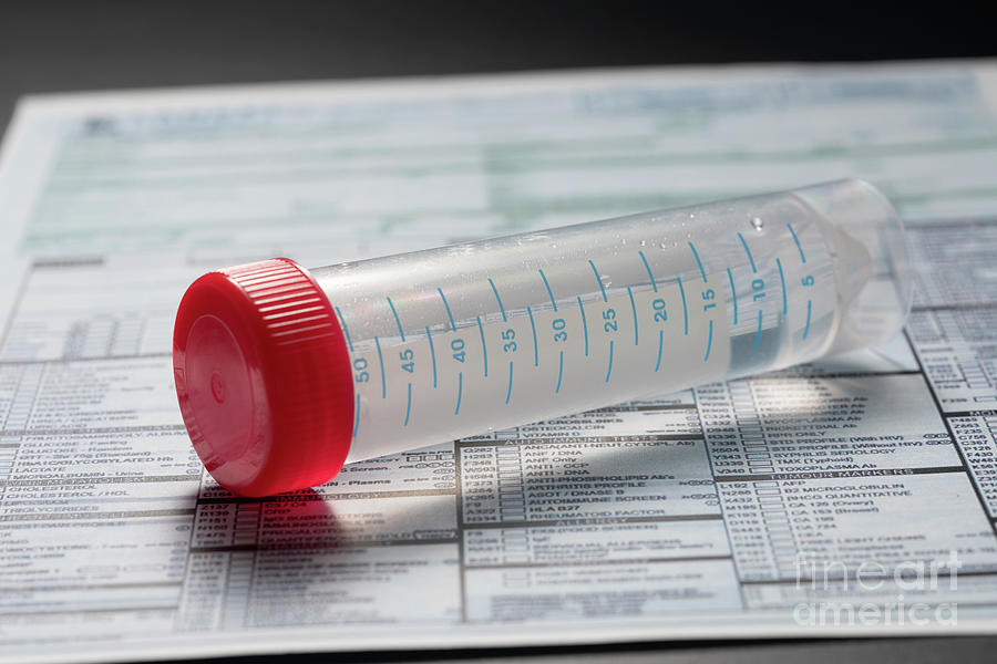 Water Sample For Analysis In Lab Photograph by Wladimir Bulgar/science ...