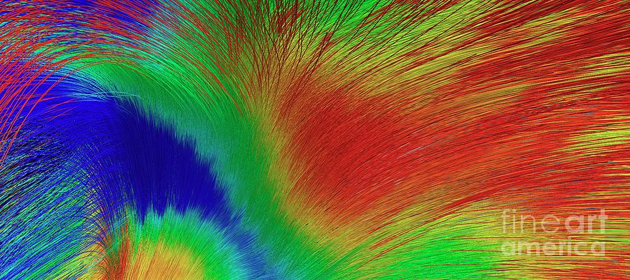 White Matter Fibres Photograph by Do Tromp/science Photo Library
