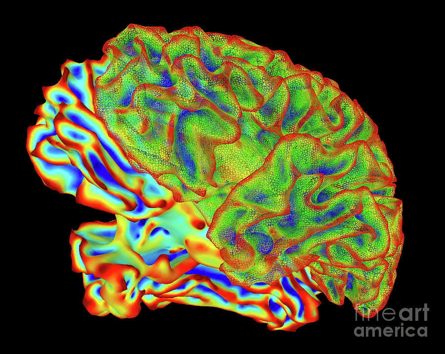 Whole Brain Image Photograph by National Institute Of Mental Health, National Institutes Of Health/science Photo Library