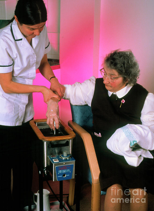 Woman Undergoing Wax Bath Treatment For Arthritis Photograph by Simon